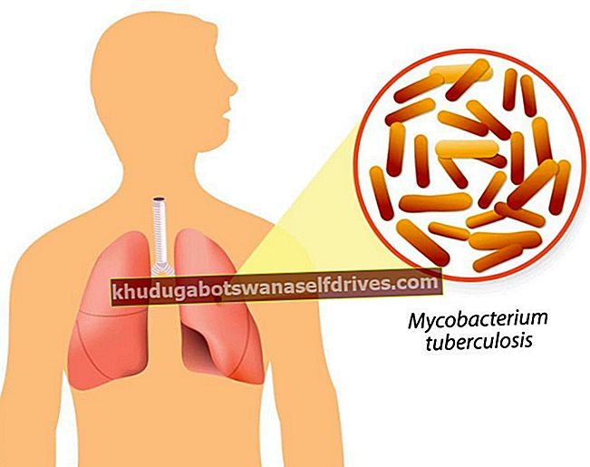A tuberkulózis megelőzése a TB megszüntetése érdekében